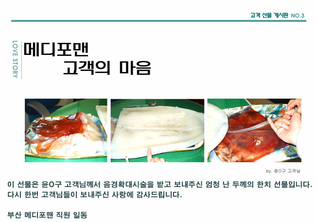 수술후기 이미지